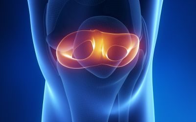 ¿Puedes caminar con un menisco desgarrado?