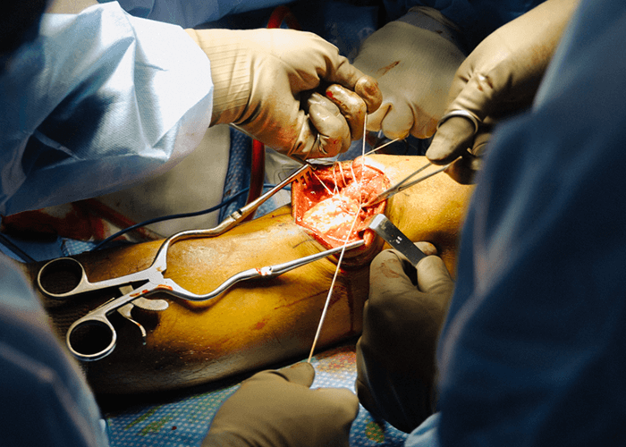 Traumatólogo Ortopedista en Guadalajara Cirugía de rodilla - Traumatólogo y Ortopedista