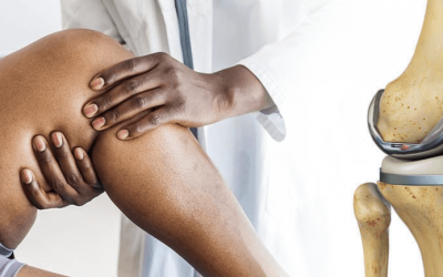 Cuanto dura una protesis de rodilla