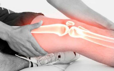 Dolor de Rodilla