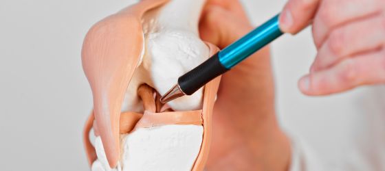¿Qué es el ligamento cruzado anterior y por qué importa tanto?