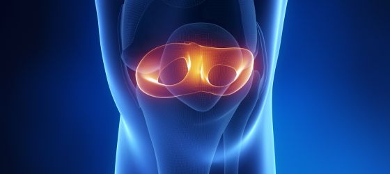 ¿Puedes caminar con un menisco desgarrado?
