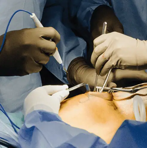 Cirugía de artroplastía o reemplazo de rodilla realizada por cirujano ortopedista