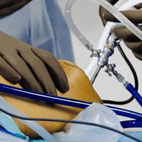 Procedimiento de artroscopia de rodilla con instrumental quirúrgico especializado