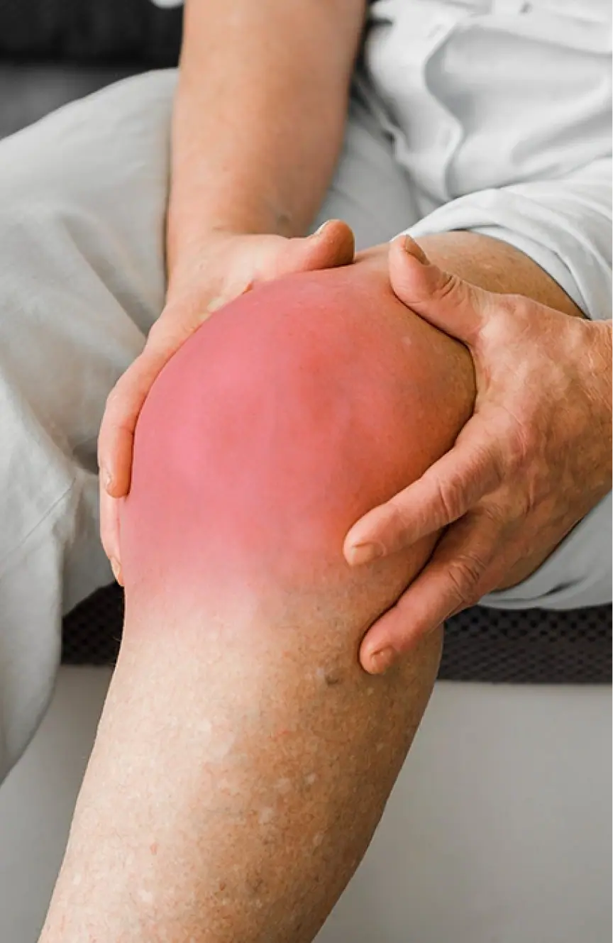 Persona sujetándose la rodilla inflamada y dolorida mostrando zona de dolor articular